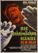 Die unheimlichen Hände des Dr. Orlak (Hands of Orlak)
